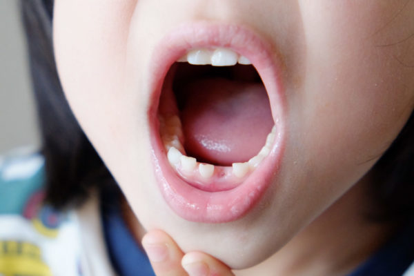 関根歯科医院 大人と子どもの矯正治療の違いとは？